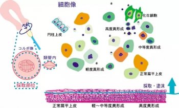 赴日体检优势项目女性精密检查