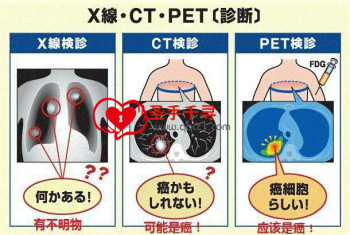 全方位了解：PET-CT