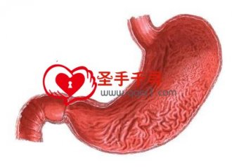 糜烂性胃炎是怎么回事？糜烂性胃炎的症状表现