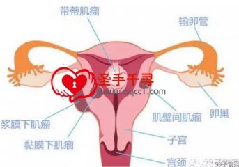 如何早期发现子宫肌瘤？子宫肌瘤前期有什么症